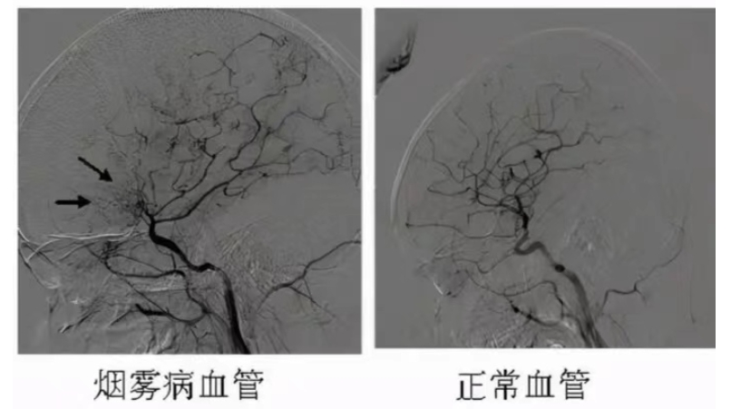 微信截图_20240605103325.png